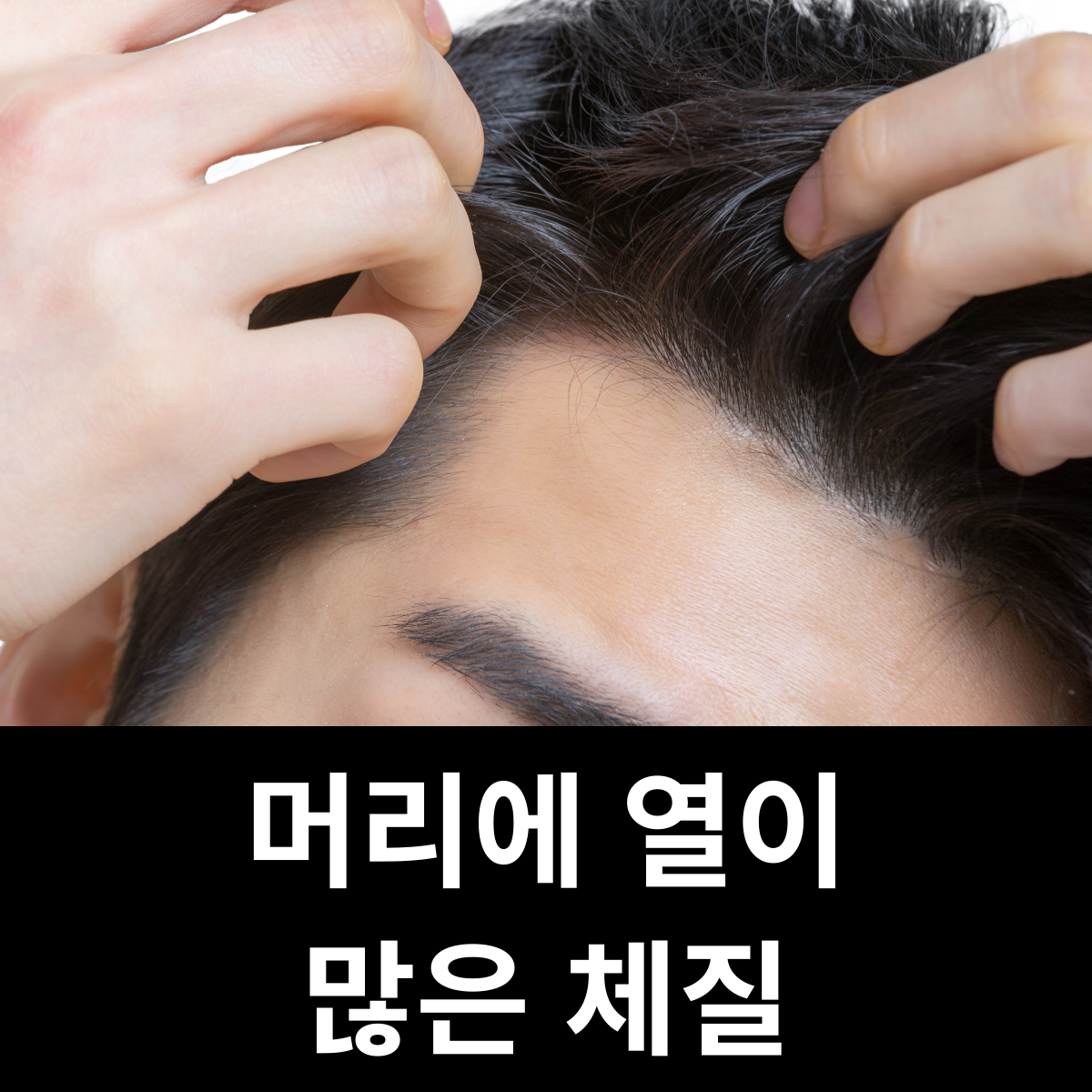 머리에 열이 많은 체질